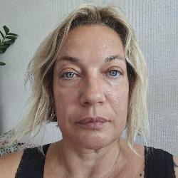 MOONETTE Caluire-et-Cuire France